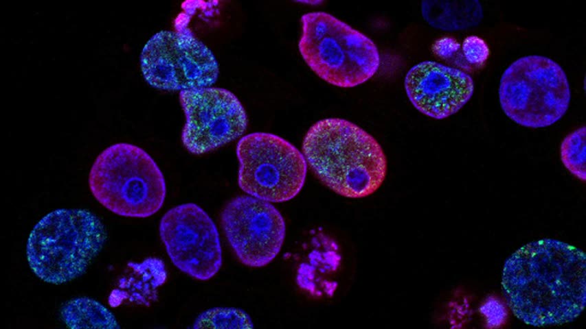 Фото - Найден способ омоложения иммунных клеток для борьбы с раком