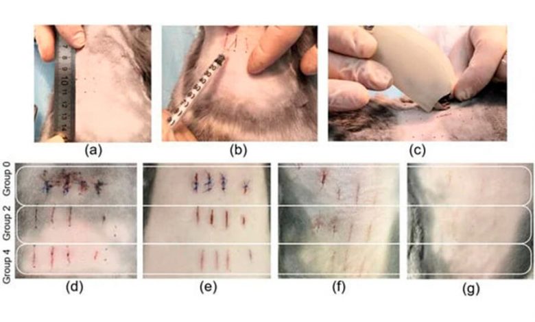 Фото - В России изобрели новый способ заживлять разрезы кожи без рубцов
