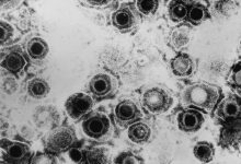 Фото - Врачи доказали эффективность генетически модифицированного вируса герпеса против рака